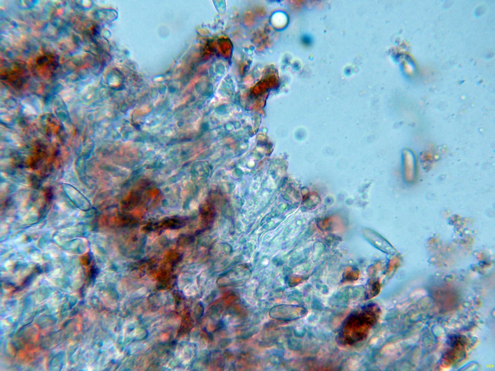 Microscopía de Ramaria pallida - 10 - Himenio-004